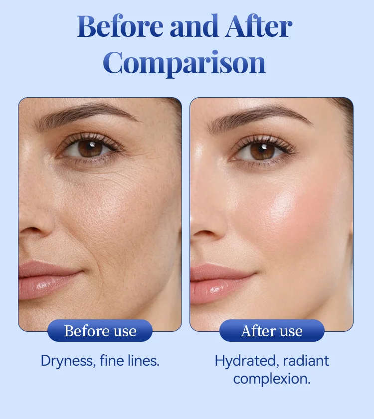 Side-by-side close-up comparison of a woman's face showing dry skin and fine lines before using a skincare product and hydrated, radiant skin after using it.